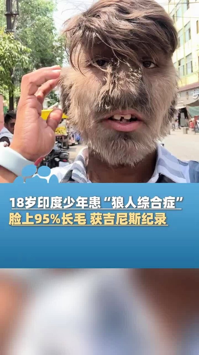 深夜18款免费视频app的相关介绍